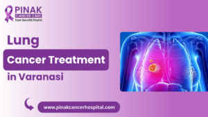Lung Cancer Treatment in Varanasi