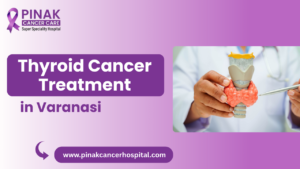 Thyroid Cancer Treatment in Varanasi