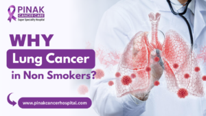 Lung Cancer in Non-Smokers