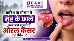 बारिश के मौसम में मुंह के छाले